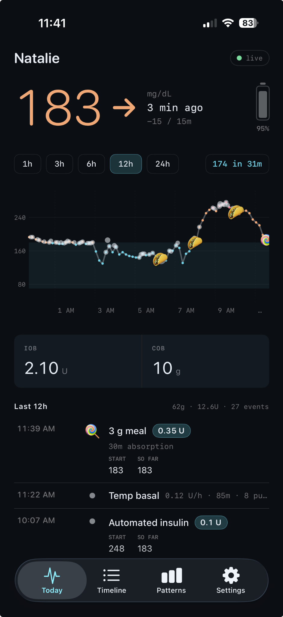 Nightscout Follow Today view in mg/dL on iPhone